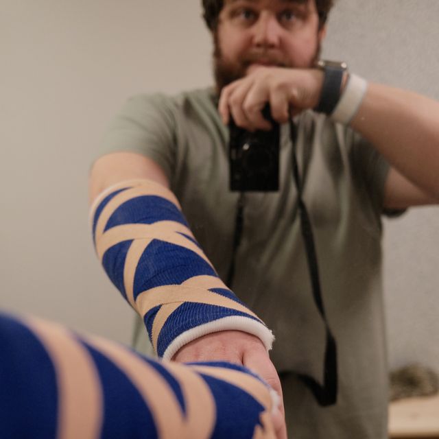 a photograph of a man with a broken arm and a broken arm
